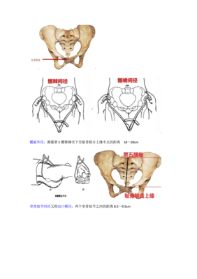 妇产骨盆平面设计方案