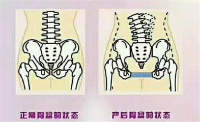 妇产骨盆平面设计方案